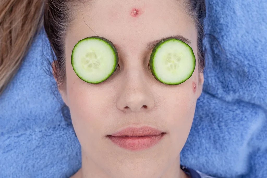 Types of acne: From clogged pores to cysts 2 Usa People Types of acne: From clogged pores to cysts